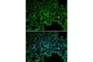 Immunofluorescence (IF) image for anti-Catenin (Cadherin-Associated Protein), delta 1 (CTNND1) (AA 573-832) antibody (ABIN3022309) (CTNND1 anticorps  (AA 573-832))