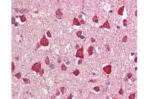 Anti-CRIM1 antibody IHC staining of human brain, cortex.