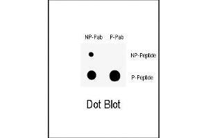 Dot blot analysis of anti-Phospho-Wee1- Antibody (ABIN389681 and ABIN2839651) on nitrocellulose membrane.