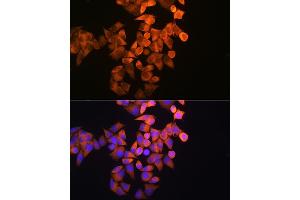 Immunofluorescence analysis of HeLa cells using RRM1 Rabbit pAb (ABIN3021562, ABIN3021563, ABIN3021564 and ABIN6215245) at dilution of 1:100 (40x lens). (RRM1 anticorps  (AA 593-792))