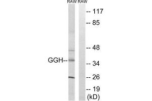 Western Blotting (WB) image for anti-gamma-Glutamyl Hydrolase (Conjugase, Folylpolygammaglutamyl Hydrolase) (GGH) (C-Term) antibody (ABIN1851354) (GGH anticorps  (C-Term))