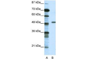 WB Suggested Anti-TADA3L Antibody Titration: 0. (TADA3L anticorps  (Middle Region))