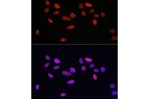 Immunofluorescence analysis of U2OS cells using Phospho-Smad2-S465/467 + Smad3-S423/425 antibody (ABIN6135314, ABIN6136248, ABIN6136249 and ABIN6225575) at dilution of 1:100. (SMAD2 / SMAD3 (pSer423), (pSer425) anticorps)