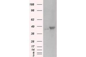 Image no. 1 for anti-Protein Kinase, CAMP-Dependent, Regulatory, Type II, alpha (PRKAR2A) antibody (ABIN1500257)