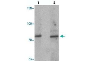 Western blot analysis of JAKMIP1 in rat brain tissue with JAKMIP1 polyclonal antibody  at (lane 1) 1 and (lane 2) 2 ug/mL. (JAKMIP1 anticorps  (Internal Region))