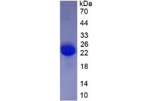 SDS-PAGE analysis of recombinant Rat VEGFA. (VEGFA Protéine)