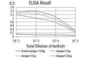 Black line: Control Antigen (100 ng),Purple line: Antigen (10 ng), Blue line: Antigen (50 ng), Red line:Antigen (100 ng)