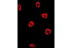 Immunofluorescent analysis of Frataxin staining in MCF7 cells.