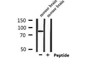 Western blot analysis of extracts from mouse brain, using TMC7 Antibody.