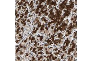 Immunohistochemical staining (Formalin-fixed paraffin-embedded sections) of human stomach with PML polyclonal antibody  shows strong cytoplasmic positivity in glandular cells. (PML anticorps)