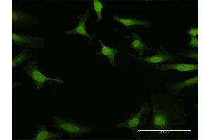 Immunofluorescence of purified MaxPab antibody to IRF5 on HeLa cell. (IRF5 anticorps  (AA 1-498))