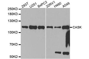 Western blot analysis of extracts of various cell lines, using CASK antibody. (CASK anticorps  (AA 1-300))