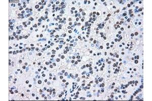 Image no. 2 for anti-Mitogen-Activated Protein Kinase Kinase 2 (MAP2K2) antibody (ABIN1499477)