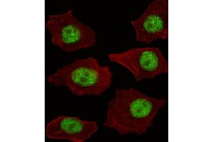 Fluorescent image of A549 cell stained with LMO4 Antibody . (LMO4 anticorps  (AA 104-131))
