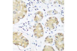 Immunohistochemistry of paraffin-embedded human stomach using TRH antibody (ABIN5974664) at dilution of 1/100 (40x lens). (TRH anticorps)
