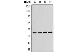 Western blot analysis of CD158b1 expression in MDAMB231 (A), Jurkat (B), mouse liver (C), H9C2 (D) whole cell lysates.