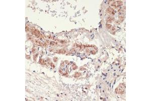 Immunohistochemistry of paraffin-embedded rat lung using A antibody (ABIN1678588, ABIN3015506, ABIN3015508 and ABIN6218562) at dilution of 1:100 (40x lens). (alpha 1 Adrenergic Receptor anticorps  (AA 346-475))