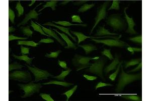 Immunofluorescence of monoclonal antibody to DNAJB6 on HeLa cell.