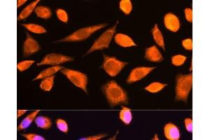 Immunofluorescence analysis of L929 cells using RPS20 Polyclonal Antibody at dilution of 1:100. (RPS20 anticorps)