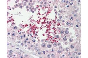 Image no. 1 for anti-ATP-Binding Cassette, Sub-Family D (ALD), Member 2 (Abcd2) (AA 338-558) antibody (ABIN467567)