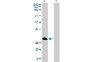Western Blot analysis of FHL1 expression in transfected 293T cell line by FHL1 monoclonal antibody (M01), clone 2A9. (FHL1 anticorps  (AA 23-120))