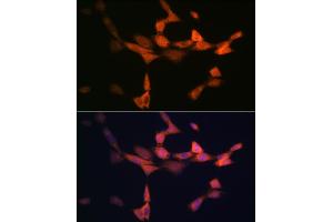 Immunofluorescence analysis of NIH-3T3 cells using PIK3R4/VPS15 Rabbit mAb (ABIN7269322) at dilution of 1:100 (40x lens).