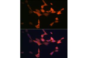 Immunofluorescence analysis of NIH-3T3 cells using PIK3R4/VPS15 Rabbit mAb (ABIN7269322) at dilution of 1:100 (40x lens). (PIK3R4 anticorps)