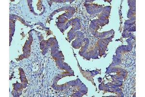 IHC analysis of SLC9A3R1 using anti-SLC9A3R1 antibody (ABIN6719642).