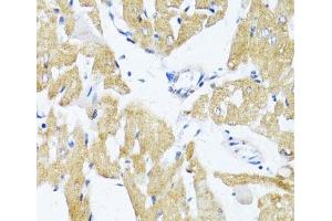 Immunohistochemistry of paraffin-embedded Rat heart using GLUT4 Polyclonal Antibody at dilution of 1:100 (40x lens).