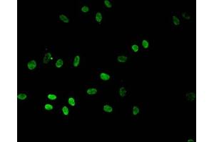 Immunofluorescent analysis of Hela cells using ABIN7139601 at dilution of 1:100 and Alexa Fluor 488-congugated AffiniPure Goat Anti-Rabbit IgG(H+L)