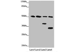 Western blot All lanes: B7H6 antibody at 2 μg/mL Lane 1: Mouse heart tissue Lane 2: Mouse liver tissue Lane 3: Mouse brain tissue Lane 4: Hela whole cell lysate Secondary Goat polyclonal to rabbit IgG at 1/10000 dilution Predicted band size: 51 kDa Observed band size: 51, 38, 32 kDa (B7-H6 anticorps  (AA 25-262))