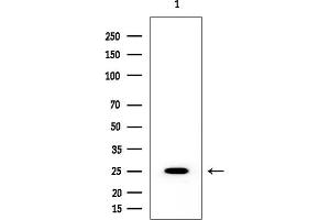 Western blot analysis of lysates from HUVEC cells, using HSP27 Mouse Monoclonal Antibody at 1/1000 dilution.