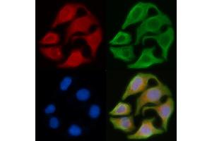 ABIN6263354 and ABIN6278592 staining Hela cells by IF/ICC. (MRGPRX4 anticorps  (C-Term))