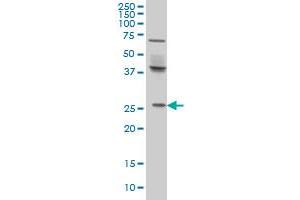 Western Blotting (WB) image for anti-PRELI Domain Containing 1 (PRELID1) (AA 3-101) antibody (ABIN599217) (PRELID1 anticorps  (AA 3-101))