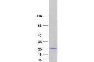 Validation with Western Blot