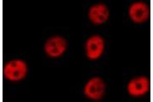 ABIN6267044 staining HeLa by IF/ICC.