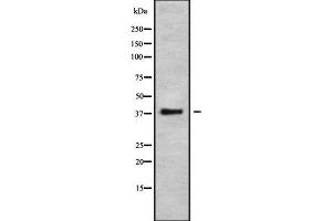 Western blot analysis of APOL6 using COLO205 whole cell lysates (APOL6 anticorps  (N-Term))