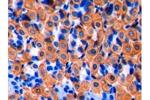 Detection of CK-BB in Mouse Stomach Tissue using Polyclonal Antibody to Creatine Kinase B (CK-BB)