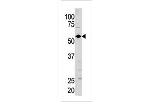 Western blot analysis of anti-GUCY1A3 Pab (ABIN391201 and ABIN2841286) in mouse brain tissue lysate (35 μg/lane).