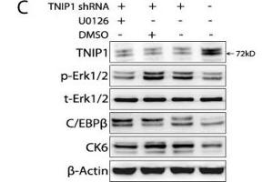 TNIP1 modulates the proliferation of keratinocytes by targeting Erk1/2 and C/EBPβ. (CEBPB anticorps  (N-Term))