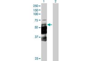 Western Blot analysis of DCP1A expression in transfected 293T cell line by DCP1A MaxPab polyclonal antibody. (DCP1A anticorps  (AA 1-582))
