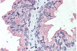 Anti-SLC39A14 antibody  ABIN960808 IHC staining of human prostate.