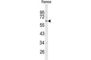 Western blot analysis of RIP3 / RIPK3 (arrow) in Ramos cell line lysates (35ug/lane) using RIPK3 / RIP3  Antibody (N-term). (RIPK3 anticorps  (N-Term))