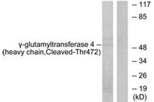 Western blot analysis of extracts from Jurkat cells, treated with etoposide 25uM 24h, using Gamma-glutamyltransferase 4 (heavy chain,Cleaved-Thr472) Antibody. (GGT7 anticorps  (Cleaved-Thr472))