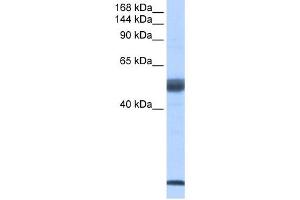 WB Suggested Anti-SF3B14 Antibody Titration:  0. (Pre-mRNA Branch Site Protein p14 (SF3B14) (Middle Region) anticorps)