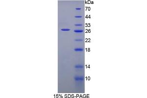 Image no. 1 for Carnitine O-Acetyltransferase (CRAT) (AA 55-256) protein (His tag) (ABIN6237789) (CRAT Protein (AA 55-256) (His tag))