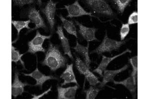 Immunofluorescent staining of HeLa cells (ATCC CCL-2).
