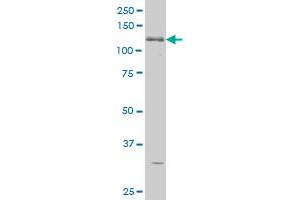 ABL2 monoclonal antibody (M09), clone 5C6 Western Blot analysis of ABL2 expression in K-562 .