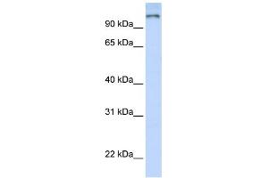 WB Suggested Anti-PAntibody Titration:  0. (PARP9 anticorps  (N-Term))