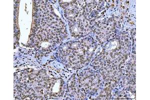 IHC analysis of AREB6/ZEB1 using anti-AREB6/ZEB1 antibody (ABIN7602990).